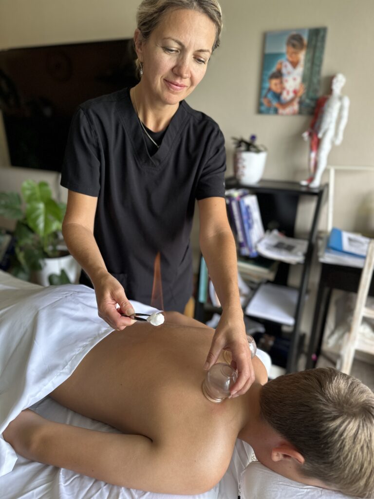 Cupping in Victoria BC at Victoria Healing Space.