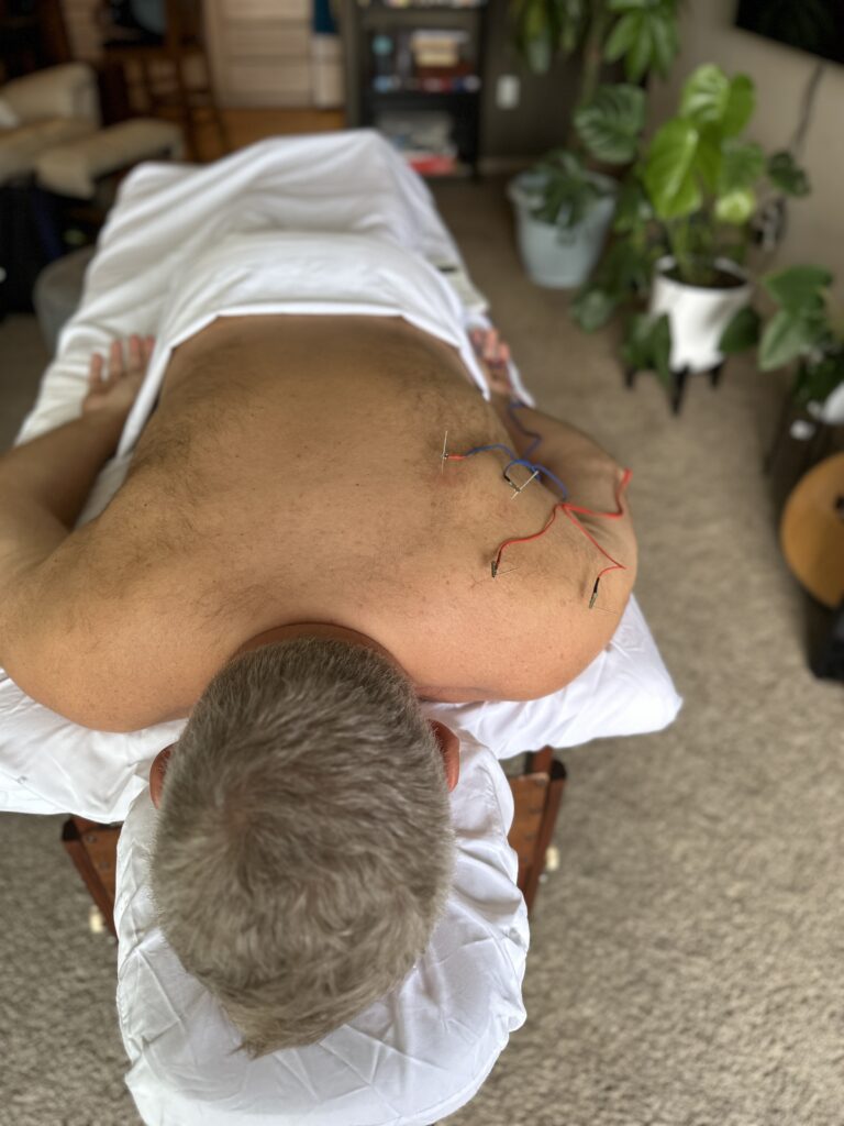Electroacupuncture in Victoria Healing Space, by Olya Dzidzverg, R.TCM.P.